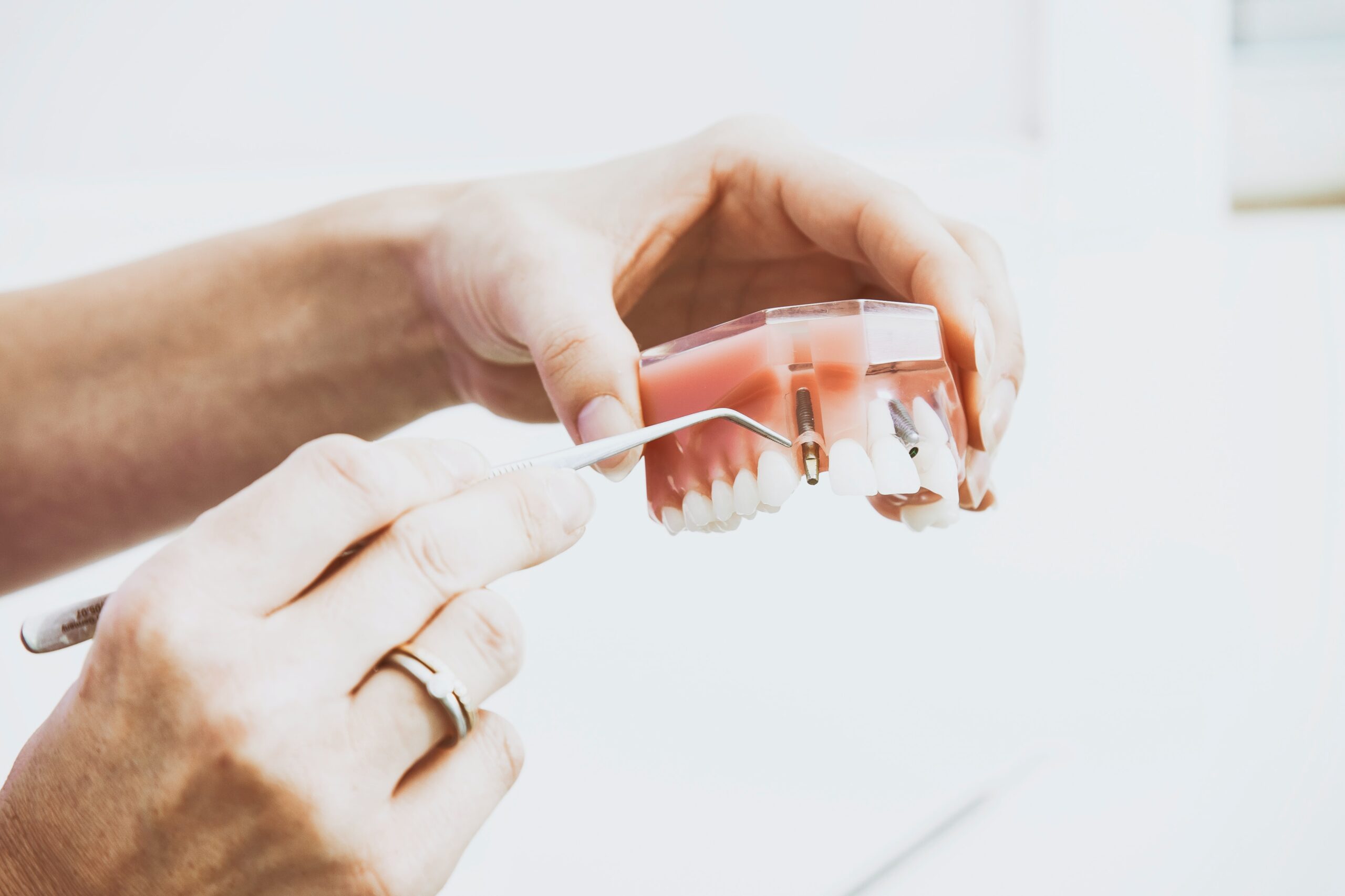What You Should Be Doing About Gum Disease